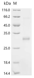 Recombinant Human Cysteine and glycine-rich protein 2 (CSRP2)