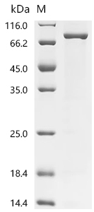 Recombinant Human Protein-arginine deiminase type-1 (PADI1)