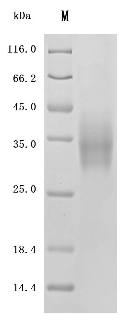 Recombinant Human Leukocyte surface antigen CD47 (CD47), partial