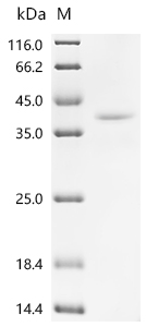 Recombinant Mouse Thyrotropin subunit beta（Tshb), partial