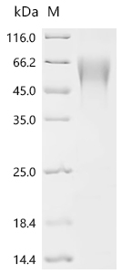 Recombinant Human metapneumovirus Major surface glycoprotein G (G), partial