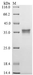 Recombinant Human Urocortin-2 (UCN2), partial