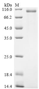 Recombinant Human Fibulin-1 (FBLN1)