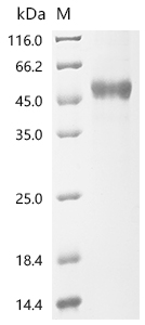 Recombinant Human Tumor necrosis factor ligand superfamily member 4 (TNFSF4), partial