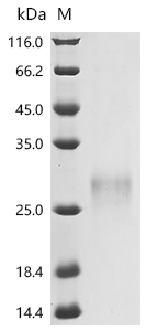 Recombinant Human Tumor necrosis factor ligand superfamily member 4 (TNFSF4), partial