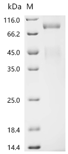 Recombinant Human Hepatocyte growth factor receptor (MET), partial