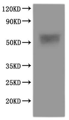Recombinant Human Urea transporter (SLC14A1)-VLPs