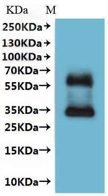 Recombinant Human Somatostatin receptor type 4 (SSTR4)-VLPs