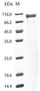 Recombinant Human Granulocyte-macrophage colony-stimulating factor receptor subunit alpha(CSF2RA), partial