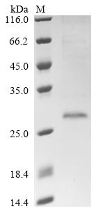 Recombinant Macaca fascicularis Ubiquitin carboxyl-terminal hydrolase isozyme L1(UCHL1), partial