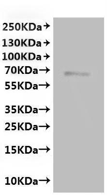 Recombinant Mouse Transient receptor potential cation channel subfamily V member 6 (Trpv6)-VLPs