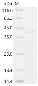 Recombinant Macaca fascicularis Inhibin subunit beta E (INHBE), partial