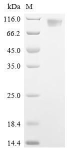 Recombinant Porcine epidemic diarrhea virus Spike glycoprotein (S), partial