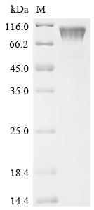 Recombinant Human metapneumovirus Major surface glycoprotein G (G), partial