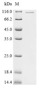 Recombinant Human Importin subunit alpha-1 (KPNA2)