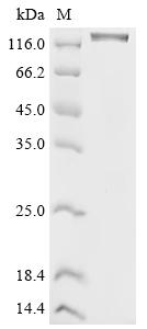 Recombinant Human Vascular endothelial growth factor receptor 2 (KDR), partial