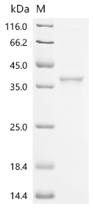 Recombinant Mouse Aldo-keto reductase family 1 member A1 (Akr1a1)