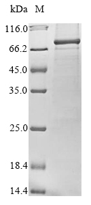 Recombinant Human Nuclear body protein SP140-like protein (SP140L)
