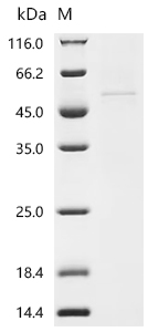 Recombinant Human E3 ubiquitin-protein ligase TRIM11 (TRIM11)