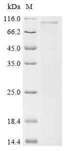 Recombinant Human Suppressor of cytokine signaling 6 (SOCS6)
