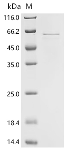 Recombinant Human Coiled-coil domain-containing protein 112 (CCDC112 )