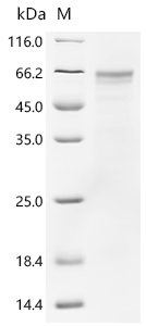 Recombinant Human Lysosomal acid glucosylceramidase (GBA1 )