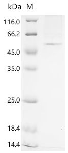 Recombinant Human 1-acylglycerol-3-phosphate O-acyltransferase PNPLA3 (PNPLA3) (I148M)