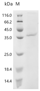 Recombinant Human Protein Wnt-5a (WNT5A)