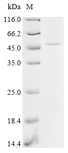 Recombinant Apis mellifera Venom acid phosphatase Acph-1