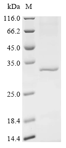 Recombinant Human Serine/threonine-protein phosphatase PGAM5, mitochondrial (PGAM5), partial