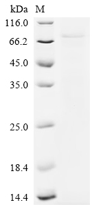 Recombinant Human Origin recognition complex subunit 1 (ORC1), partial