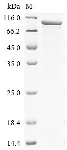 Recombinant Influenza A virus Polymerase basic protein 2 (PB2)