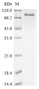 Recombinant Human Lactotransferrin (LTF)
