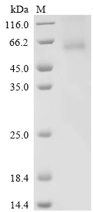 Recombinant Human 1-acylglycerol-3-phosphate O-acyltransferase PNPLA3 (PNPLA3) (I148M)