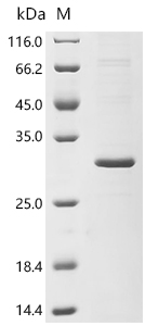 Recombinant Human Cancer/testis antigen 1 (CTAG1A)