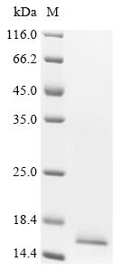 Recombinant Human Bromodomain-containing protein 2 (BRD2), partial
