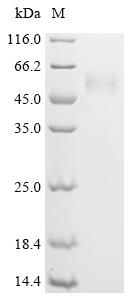 Recombinant Human Signal recognition particle subunit SRP54 (SRP54)