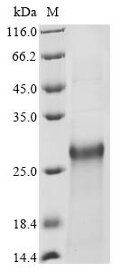 Recombinant Human Protein PML (PML), partial