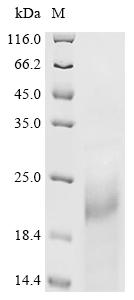 Recombinant Mouse Cyclin-dependent kinase inhibitor 1 (Cdkn1a)
