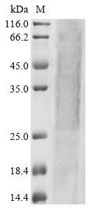 Recombinant Rat Aldehyde dehydrogenase, mitochondrial (Aldh2)