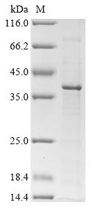 Recombinant Rat Cathepsin Z(Ctsz)