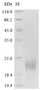 Recombinant Porcine reproductive and respiratory syndrome virus Nucleoprotein (N)