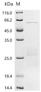 Recombinant Human Ras-related protein Rab-6B (RAB6B)