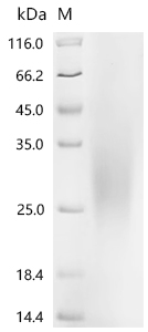 Recombinant Chicken Platelet derived growth factor subunit B (PDGF-B), partial
