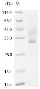 Recombinant Human Transcriptional enhancer factor TEF-1 (TEAD1), partial