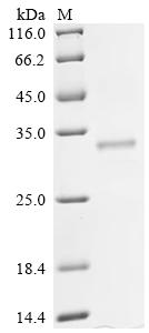 Recombinant Human Protein mono-ADP-ribosyltransferase PARP16 (PARP16), partial