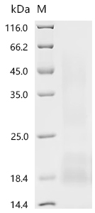 Recombinant Human Myosin regulatory light chain 12B(MYL12B)