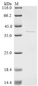 Recombinant Mumps virus Fusion glycoprotein F0 (F), partial