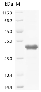 Recombinant Human metapneumovirus Major surface glycoprotein G (G), partial