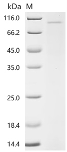 Recombinant Human Importin subunit beta-1 (KPNB1)